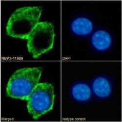TIM-3 Rabbit anti-Mouse, Clone: 2C12, Novus Biologicals 0.2 mg; Unconjugated:Antibodies,